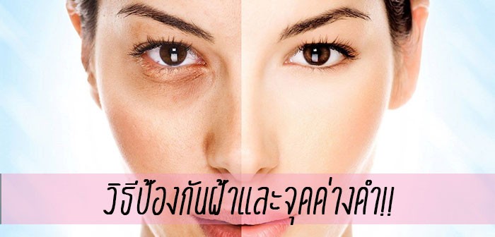 วิธีรักษาจุดด่างดำ