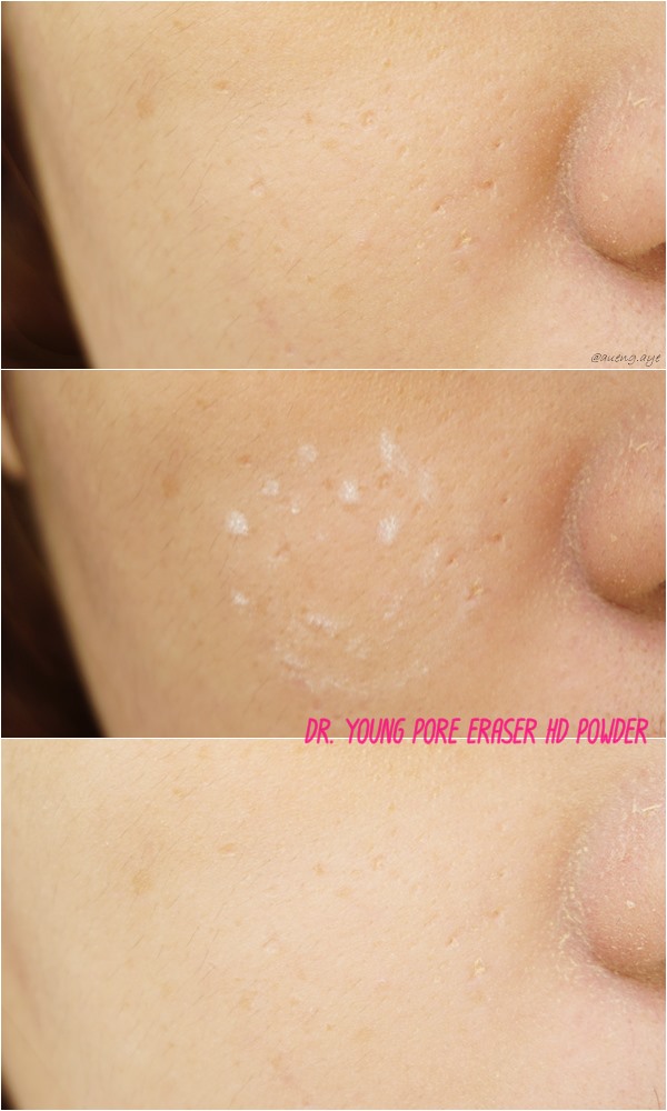 Dr. Young Pore Eraser HD POWDER - รีวิว