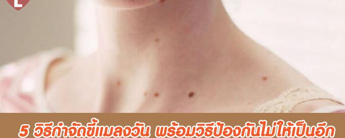 5 วิธีกำจัดขี้แมลงวัน พร้อมวิธีป้องกันไม่ให้เป็นอีก