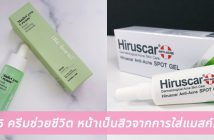 เป นส วอ ดต นไม ยอมหาย ทำไงด Ladyissue เว บร ว วเคร องสำอาง ช มชนผ หญ ง ฮาวท แต งหน า อ พเดทแบรนด เนม เทรนด แฟช นจากด ไซเนอร ช อด ง เป นส วอ ดต นไม ยอมหาย ทำไงด Ladyissue เว บร ว วเคร องสำอาง ช มชนผ หญ ง ฮาวท แต งหน า อ พเดทแบรนด เนม เทรนด แฟช นจากด ไซเนอร ช อด ง