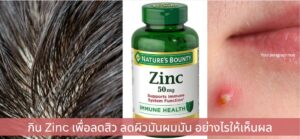 กิน Zinc เพื่อลดสิว ลดผิวมันผมมัน อย่างไรให้เห็นผลและกินได้แค่กี่เม็ดต่อวัน