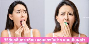 วิธีดับกลิ่นปากพวกกระเทียม หอมแดงในลมหายใจ แบบเห็นผลไวสุด